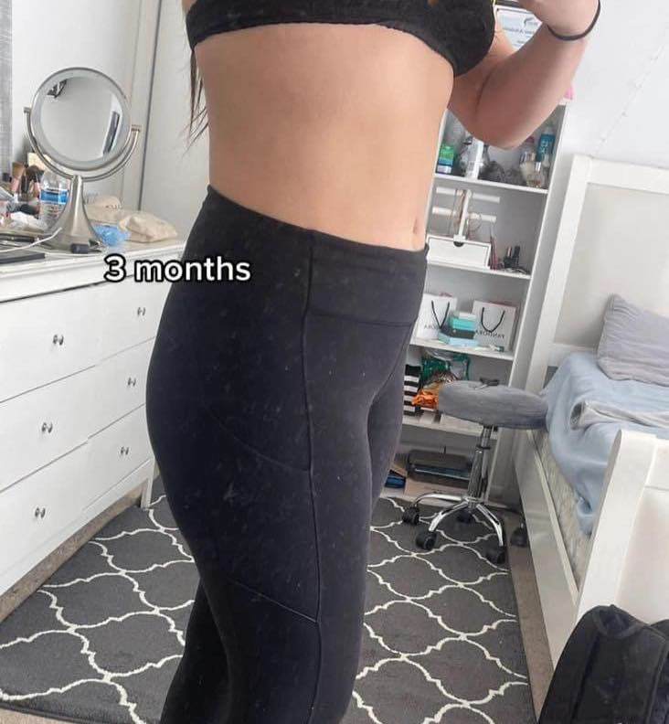 Mẹ bầu 9 tháng đi đẻ bụng vẫn phẳng lì, bác sĩ không tin đây là sản phụ sắp lâm bồn - 2