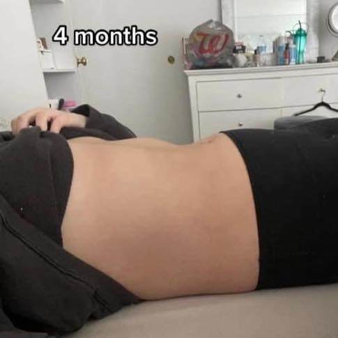 Mẹ bầu 9 tháng đi đẻ bụng vẫn phẳng lì, bác sĩ không tin đây là sản phụ sắp lâm bồn - 3