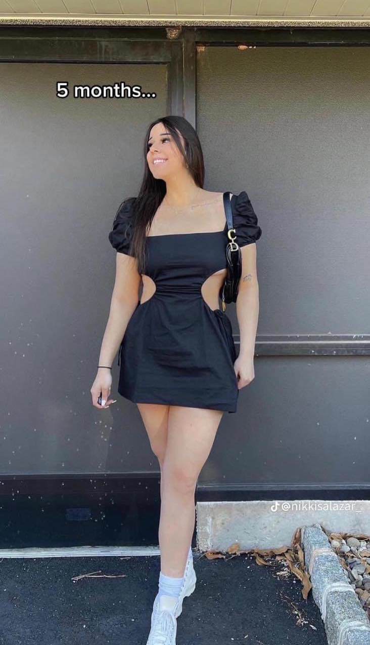 Mẹ bầu 9 tháng đi đẻ bụng vẫn phẳng lì, bác sĩ không tin đây là sản phụ sắp lâm bồn - 4