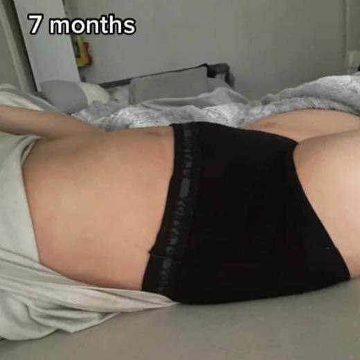 Mẹ bầu 9 tháng đi đẻ bụng vẫn phẳng lì, bác sĩ không tin đây là sản phụ sắp lâm bồn - 6