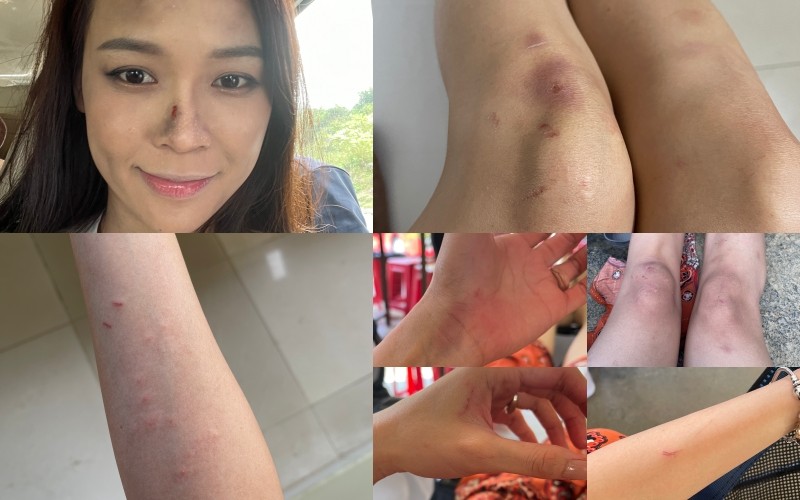 Sao Việt gặp tai nạn trên phim trường gây chú ý nhất năm qua - 5