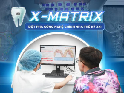 Thông tin doanh nghiệp - Niềng răng mắc cài nhân đôi hiệu quả với công nghệ X-Matrix