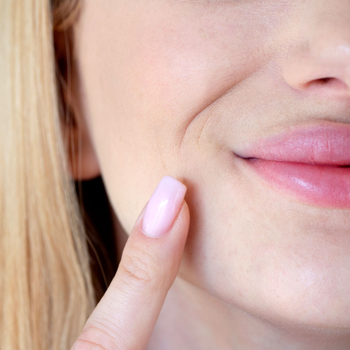 Cách hiệu quả nhất để làm phẳng đường rãnh cười già nua - 1