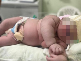 Bé sơ sinh chào đời nặng 7.3kg, gần bằng trẻ 1 tuổi khiến ê-kíp đỡ đẻ ngỡ ngàng