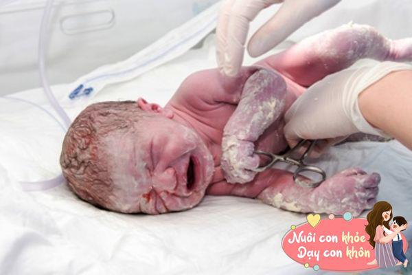Mẹ buồn rầu khi con mới sinh quá “xấu xí”, nhưng y tá lại nói: Sau 3 tháng, bố mẹ sẽ ngạc nhiên vì vẻ xinh xắn này - 3