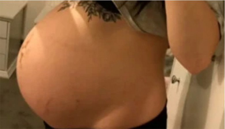 Mẹ bầu tưởng bàn chân thai nhi bị đạp nên đau xương sườn, bác sĩ kết luận bất ngờ - 1