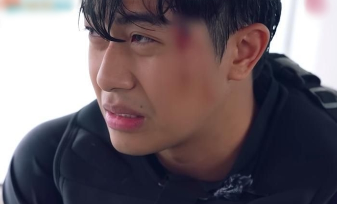 Một sao nam bị trật khớp vai, chấn thương chảy máu trong show "2 ngày 1 đêm" - 2