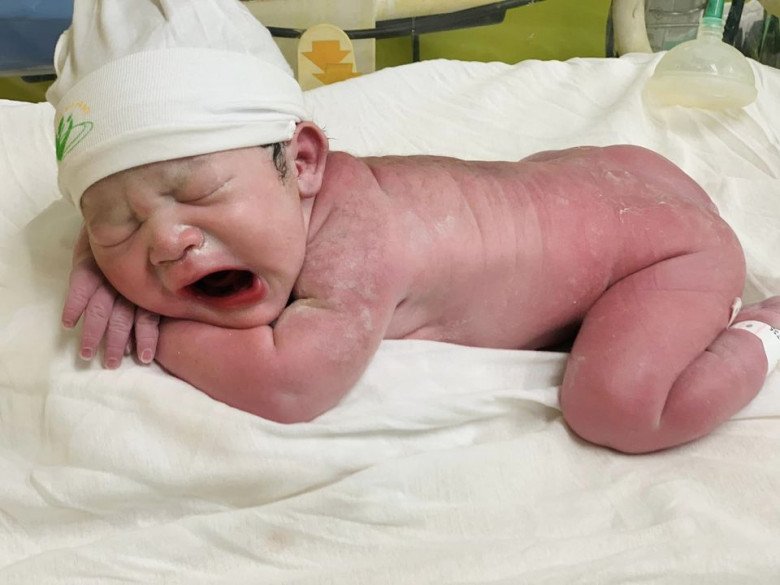 3 lần đình chỉ thai kỳ, mẹ Hòa Bình phải uống thuốc giữ thai đến lúc lên bàn mổ - 1