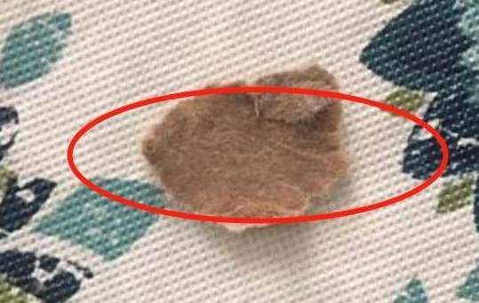 Phát hiện đốm đen kỳ lạ trong miệng con, mẹ lập tức đi khám, bác sĩ nói: Thật đáng mừng! - 2
