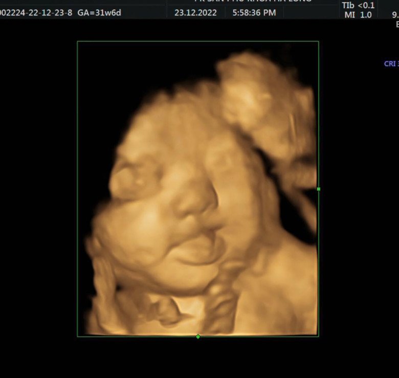 Mẹ bầu 32 tuần đi siêu âm, bác sĩ bắt trọn khoảnh khắc thai nhi cười toe toét trong bụng mẹ - 1