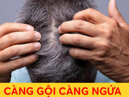 Thông tin doanh nghiệp - Tại sao tóc càng gội càng ngứa, ngã ngửa khi biết lý do này