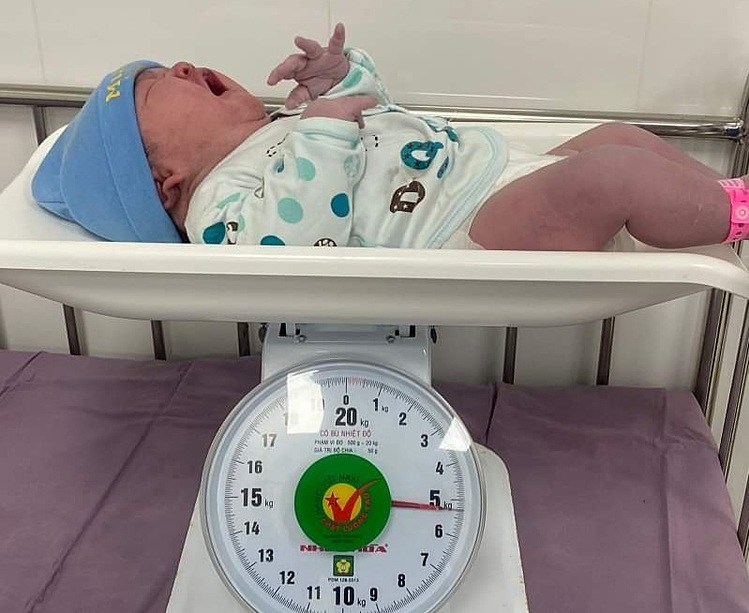 Quá ngày dự sinh, bé gái Quảng Ninh chào đời nặng 5.3kg, tương đương trẻ 2 tháng tuổi - 1