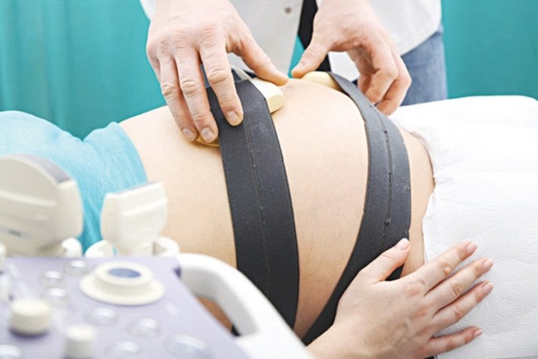 Vì sao mẹ bầu phải theo dõi tim thai, đo cơn gò bằng máy Monitoring trong thai kỳ? - 1
