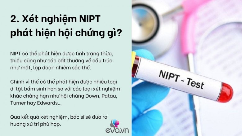 Tất tần tật về xét nghiệm NIPT sàng lọc dị tật thai nhi và những lý do mẹ bầu nên làm - 3