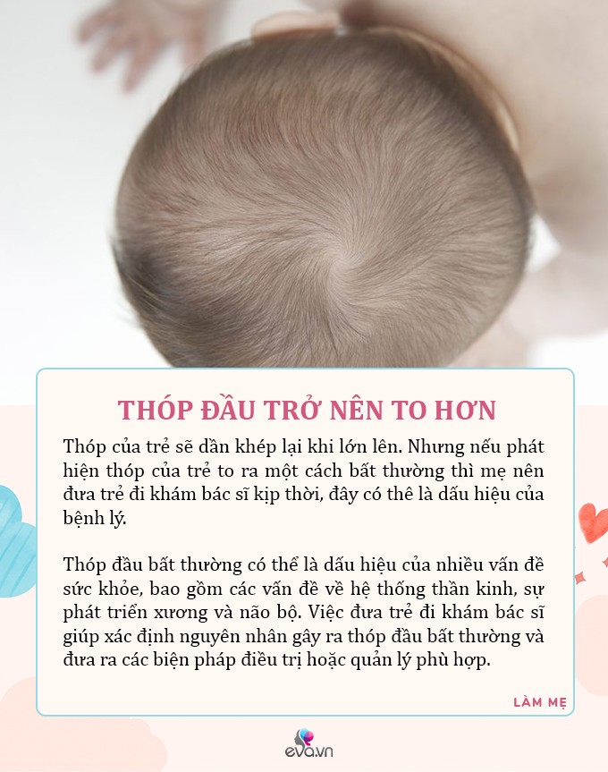 7 tín hiệu ngoại hình trên da, tóc cho thấy trẻ sơ sinh đang không ổn về sức khoẻ, nên đưa con đi kiểm tra - 2