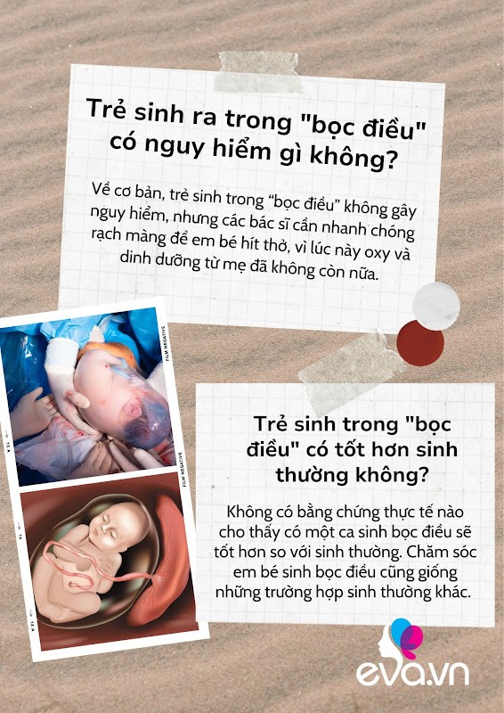 1 trong 2 bé sinh đôi nhà Sam chào đời trong túi ối: Tại sao trẻ sinh trong &#34;bọc điều&#34; được coi là may mắn? - 3