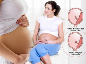Nhau thai bám thấp: Tình trạng mẹ bầu nào cũng sợ gặp phải và các nguy hiểm cần biết