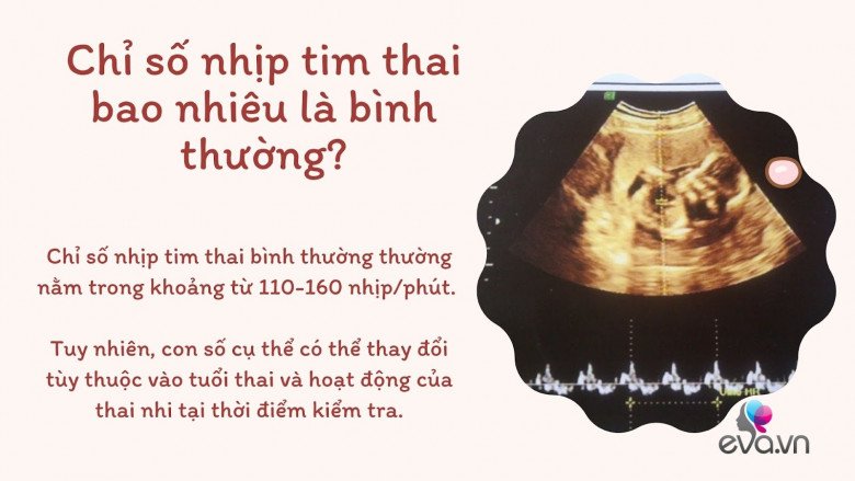 Nhịp tim thai của bé trong bụng mẹ tiết lộ điều gì? - 6