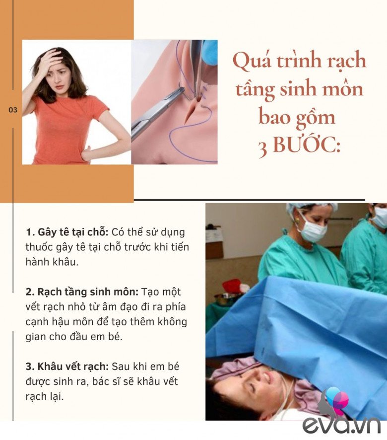Có bao nhiêu mẹ ở đây hiểu đúng về RẠCH và KHÂU tầng sinh môn khi sinh thường? - 3
