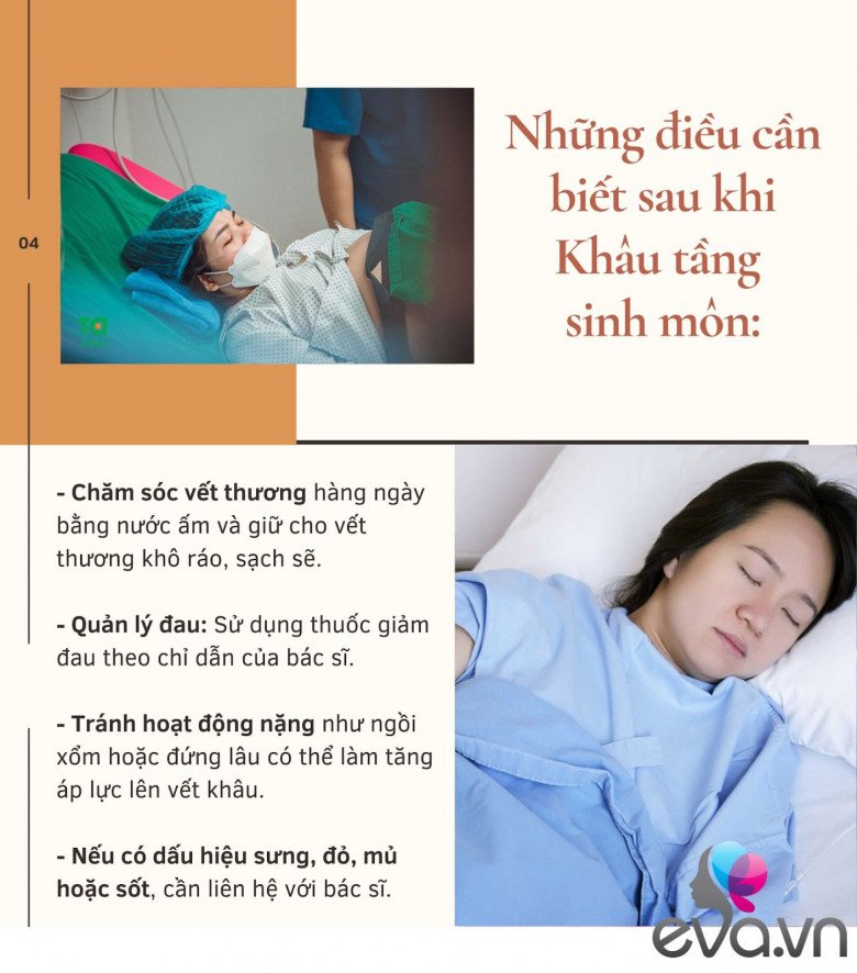Có bao nhiêu mẹ ở đây hiểu đúng về RẠCH và KHÂU tầng sinh môn khi sinh thường? - 4