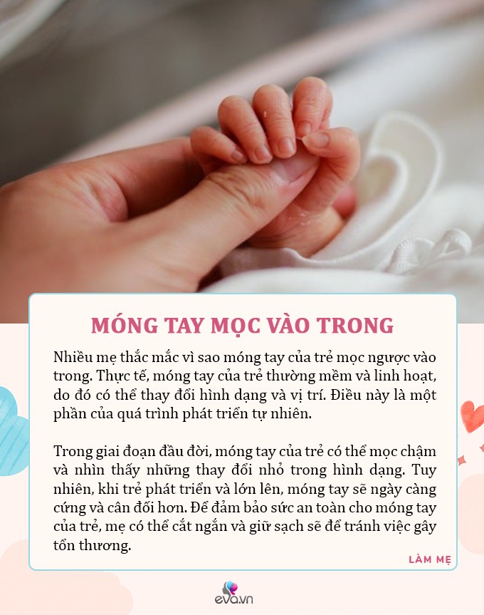 Trẻ có 6 đặc điểm “bất thường” sau khi sinh, ai lần đầu làm bố mẹ nên biết - 4