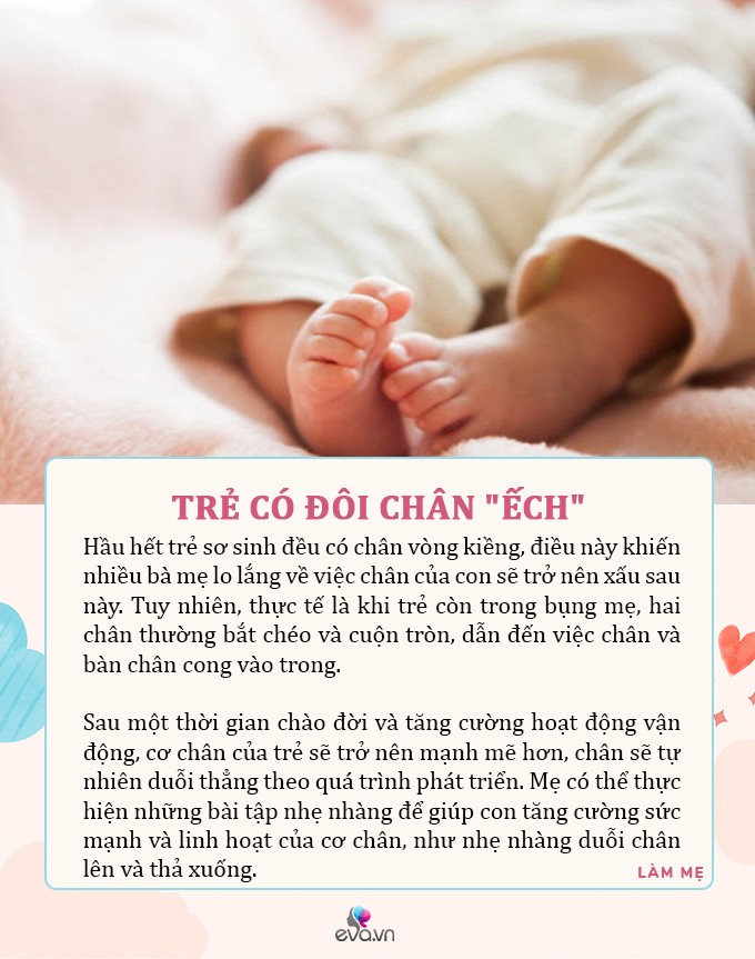 Trẻ có 6 đặc điểm “bất thường” sau khi sinh, ai lần đầu làm bố mẹ nên biết - 5