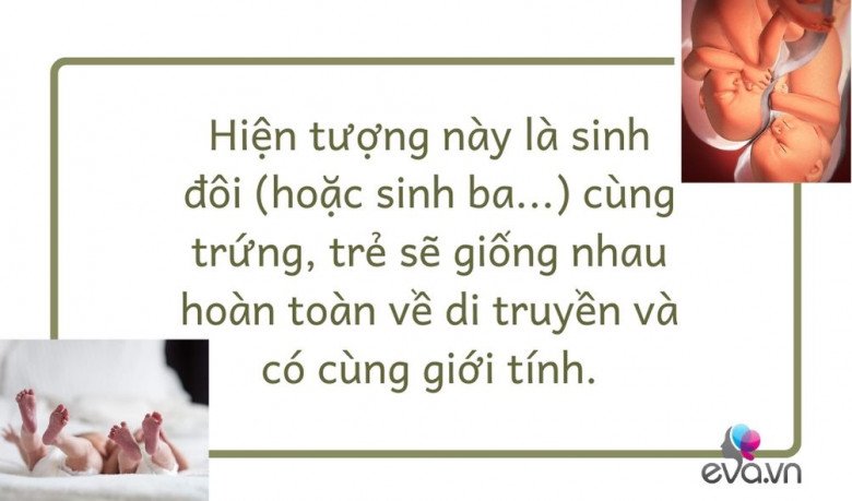 Mang thai theo phương pháp IVF nhưng sinh đôi tự nhiên: Hiếm gặp và là điều kì diệu - 4