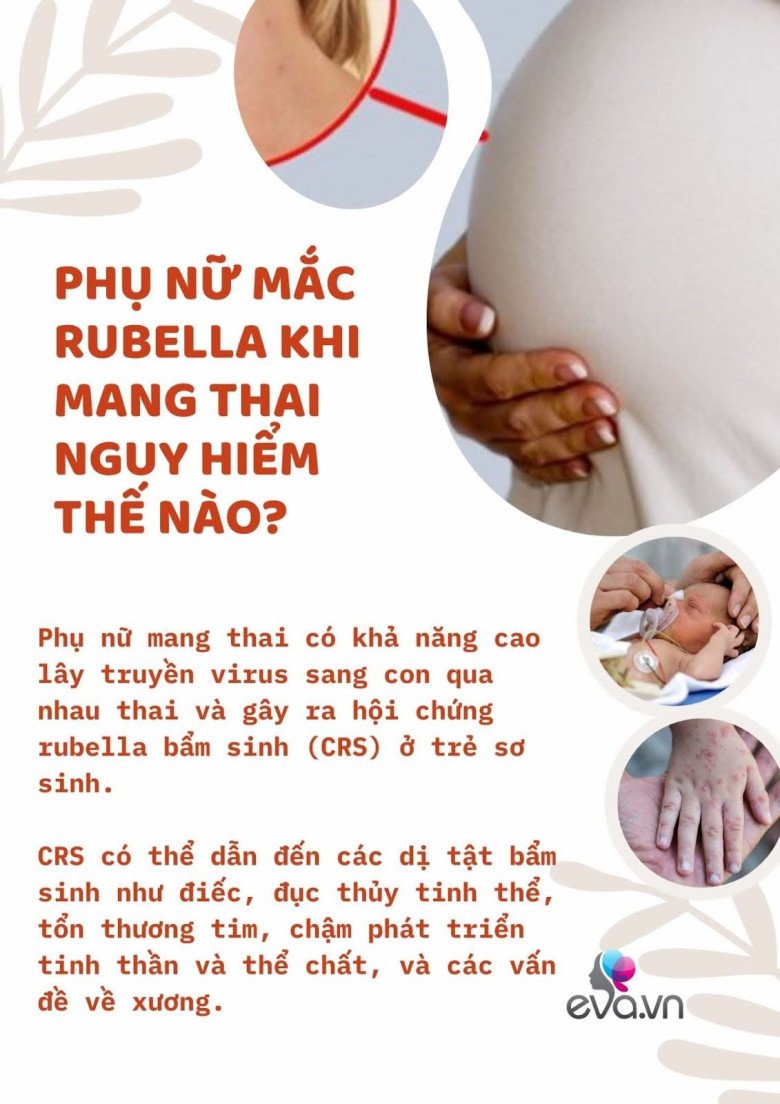 Từ ca mắc rubella đầu tiên trong năm 2024 ở Hà Nội, mẹ bầu cần làm gì để phòng bệnh? - 2