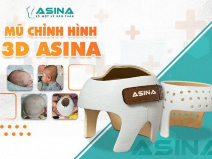 Thông tin doanh nghiệp - ASINA – Đơn vị tiên phong ứng dụng công nghệ 3D trong điều trị hội chứng đầu méo, đầu bẹt cho trẻ em Việt Nam