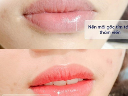 Thông tin doanh nghiệp - Thẩm mỹ viện Seoul Center - Điểm đến phun môi đẹp, an toàn, bền màu