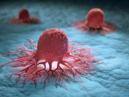 Thông tin doanh nghiệp - 3 nguyên tắc vàng ngăn sự hình thành khối u