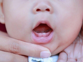 Dấu hiệu mọc răng và cách chăm sóc răng mới nhú