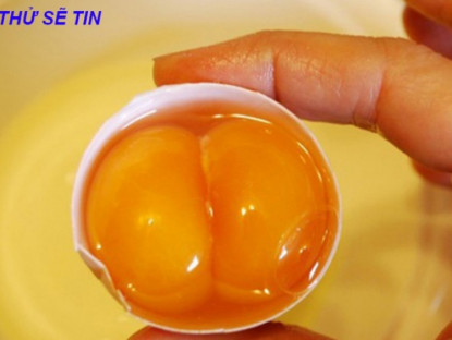 Thông tin doanh nghiệp - Ai mất ngủ, khó ngủ, trằn trọc kéo dài không rõ nguyên nhân thì phải đọc ngay bài này đảm bảo không hối tiếc