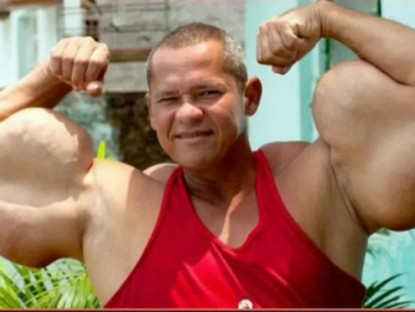 Thể thao - "Người khổng lồ Hulk đời thực" bắp tay có chu vi 74cm, qua đời vì sử dụng thuốc tự chế
