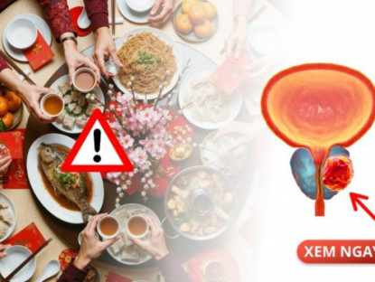 Thông tin doanh nghiệp - Tết vui quá đà, đấng mày râu coi chừng: 6 thói quen ngày xuân đang lặng lẽ nuôi lớn tuyến tiền liệt