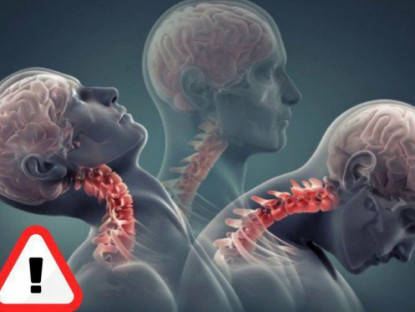 Thông tin doanh nghiệp - Đau lưng, mỏi vai gáy, tê bì chân tay “đeo bám” - Tố cáo bạn “phạm” sai lầm này!