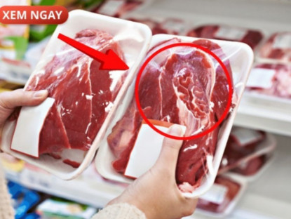 Thông tin doanh nghiệp - 5 loại thực phẩm cực hại cho tuyến tiền liệt của phái mạnh, nhiều người vẫn vô tư ăn mỗi ngày