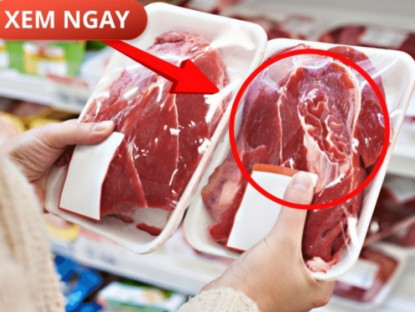 Thông tin doanh nghiệp - 5 loại thực phẩm cực hại cho tuyến tiền liệt của phái mạnh, nhiều người vẫn vô tư ăn mỗi ngày