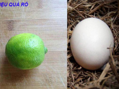 Thông tin doanh nghiệp - Vì sao trào ngược dạ dày, viêm loét dạ dày lại phổ biến tại Việt Nam, cách giải quyết hiệu quả lại đơn giản không ngờ