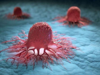 Thông tin doanh nghiệp - 3 nguyên tắc vàng ngăn sự hình thành khối u