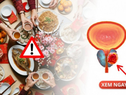 Thông tin doanh nghiệp - Tết vui quá đà, đấng mày râu coi chừng: 6 thói quen ngày xuân đang lặng lẽ nuôi lớn tuyến tiền liệt