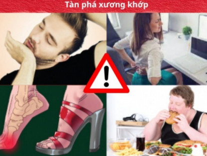 Thông tin doanh nghiệp - 5 thói quen “tàn phá” xương khớp - nên bỏ càng sớm càng tốt