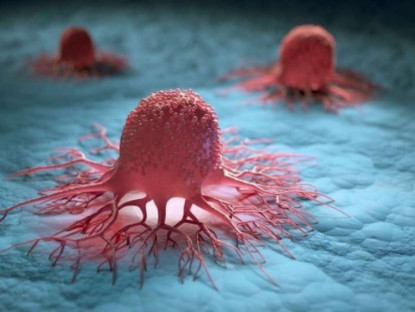 Thông tin doanh nghiệp - 3 nguyên tắc vàng ngăn sự hình thành khối u