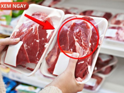 Thông tin doanh nghiệp - 5 loại thực phẩm cực hại cho tuyến tiền liệt của phái mạnh, nhiều người vẫn vô tư ăn mỗi ngày