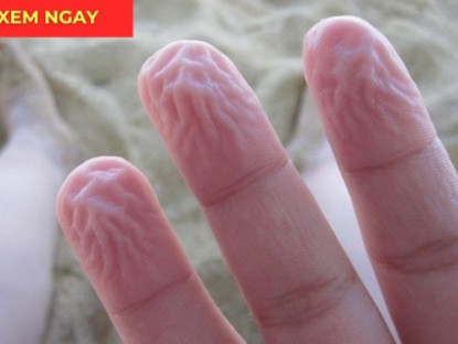 Thông tin doanh nghiệp - Nhiều người bỏ qua dấu hiệu này, đến khi đau đến mức bật khóc mới phát hiện thoát vị đĩa đệm thì đã muộn