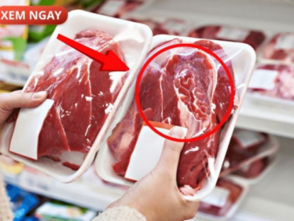 Thông tin doanh nghiệp - 5 loại thực phẩm cực hại cho tuyến tiền liệt của phái mạnh, nhiều người vẫn vô tư ăn mỗi ngày