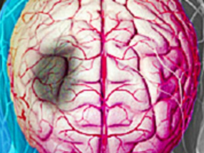 Thông tin doanh nghiệp - Bị mất ngủ, khó ngủ mà không biết điều này sẽ cực kỳ nguy hiểm, người mất ngủ đọc ngay thông tin này để không phải hối tiếc