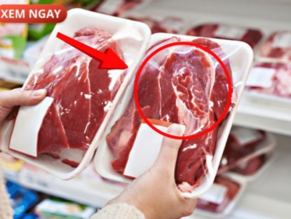 Thông tin doanh nghiệp - 5 loại thực phẩm cực hại cho tuyến tiền liệt của phái mạnh, nhiều người vẫn vô tư ăn mỗi ngày