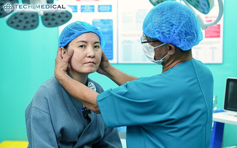 Thắt cơ vi điểm, giải pháp trẻ hóa được nhiều chị em Việt Kiều lựa chọn - 1