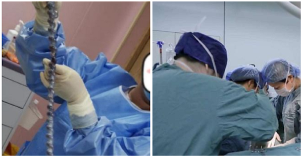 Em bé chào đời dây rốn xoắn tít như lò xo, bác sĩ lắc đầu: "Sao nghịch quá?" - 1